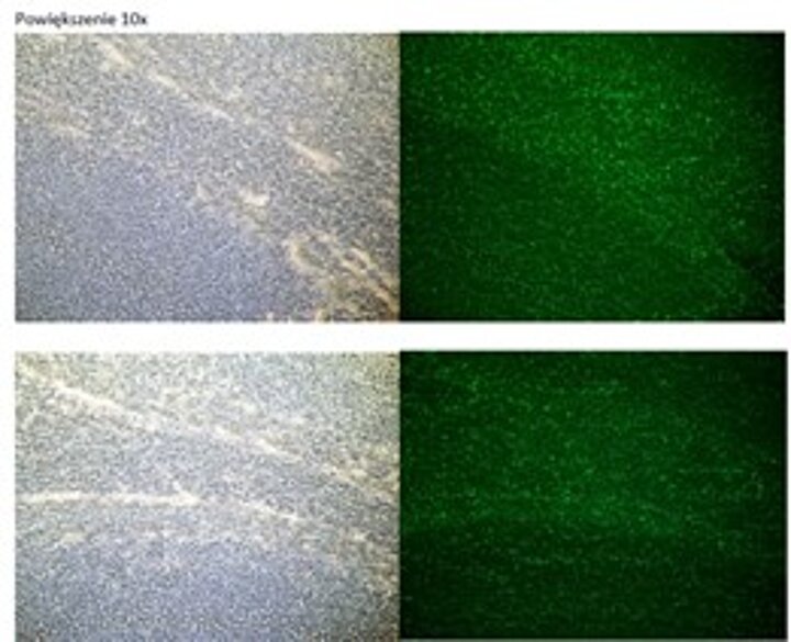 Skrawki mózgu szczura w świetle VIS A) oraz B) skrawki z widoczną w UV pepstatyną znakowaną karboksyfluoresceiną