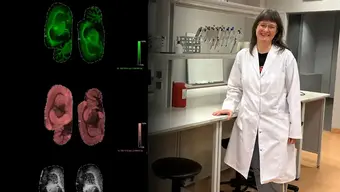 Prof. Anna Bodzoń-Kułakowska – naukowa podróż pełna odkryć Prof. Anna Bodzoń-Kułakowska – naukowa podróż pełna odkryć